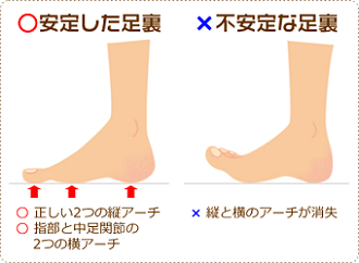 図：安定した足裏と不安定な足裏